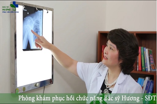 Điều trị phục hồi chức năng cho bệnh nhân gãy trật khớp vai